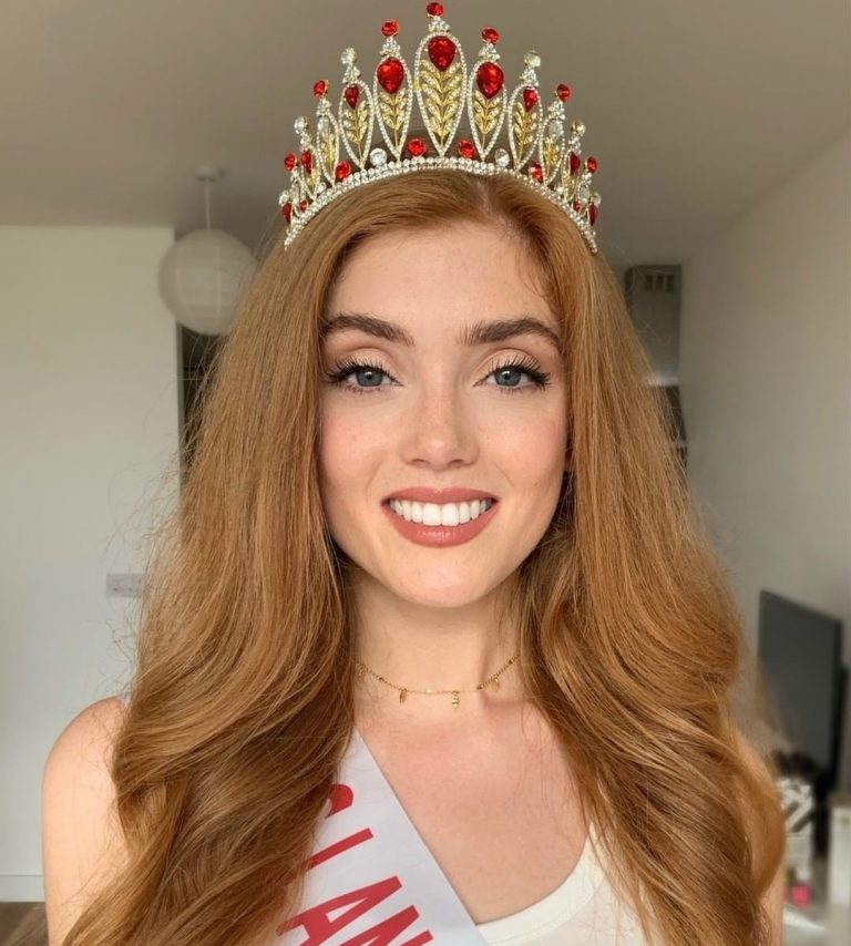 Beating The Bullies For Redheads Everywhere Miss England Contest